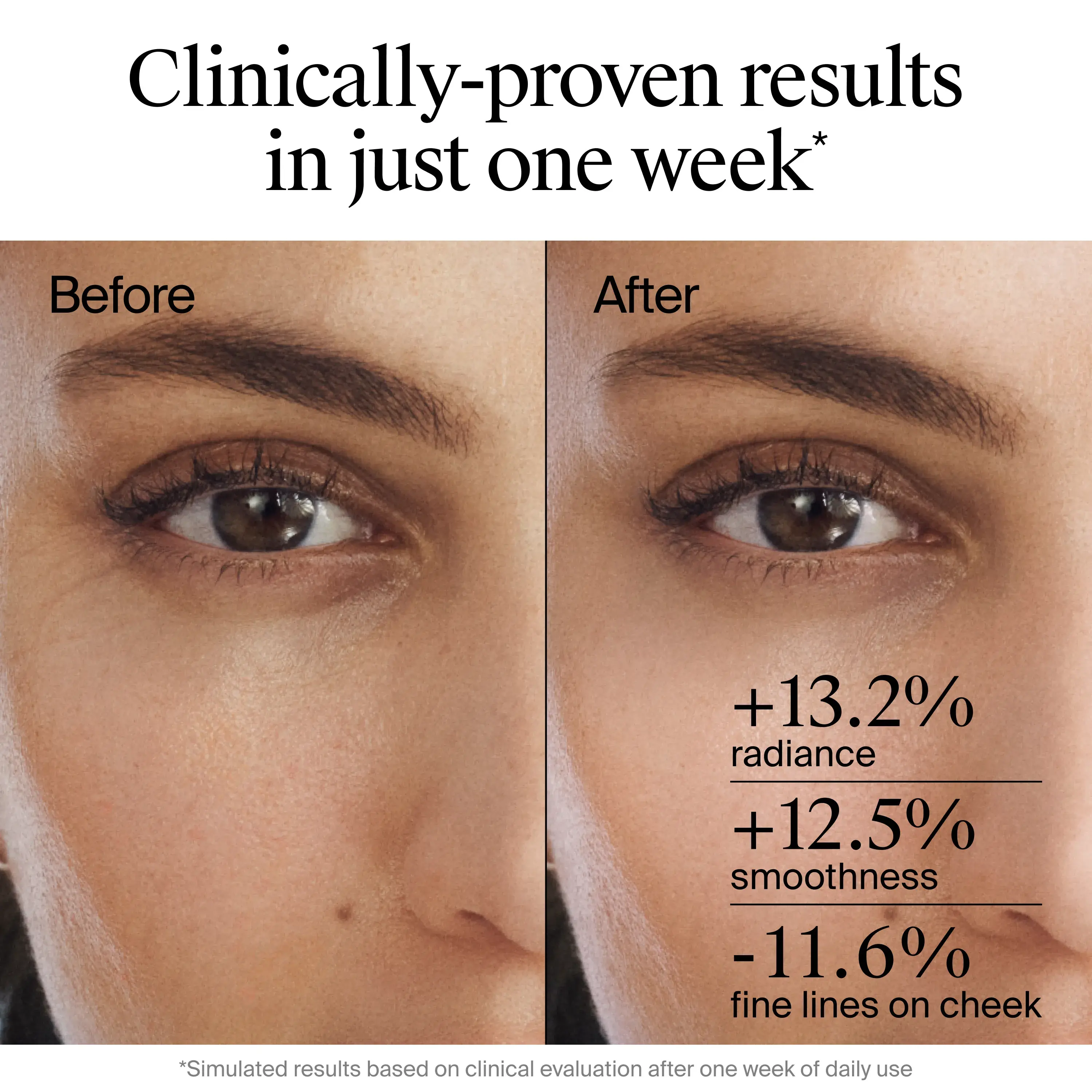Rapid Wrinkle Repair Retinol Renewal Serum with Clinically-proven results in just one week, before and after image.