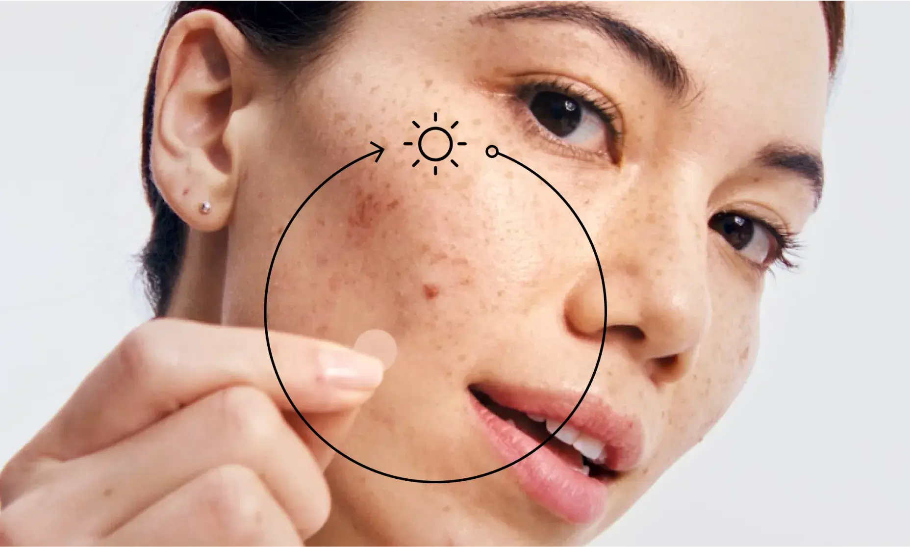 A young woman with an Neutrogena® mini acne patch on her cheek.