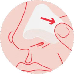 Step 3, remove patch. To remove, carefully loosen one end of the patch by stretching it along the skin slowly. Do not pull upward.