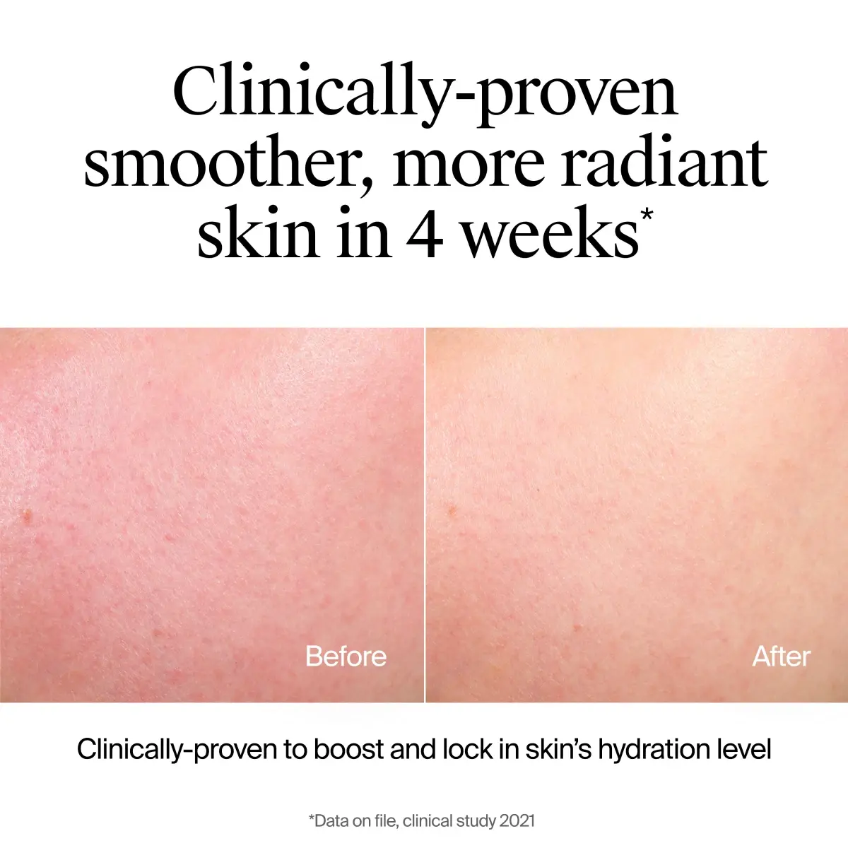 Neutrogena Hydro Boost Hydrating Cleansing Gel, Fragrance Free, 7.8 Fl. Oz Before and After, Clinically proven smoother more radiant skin in 4 weeks