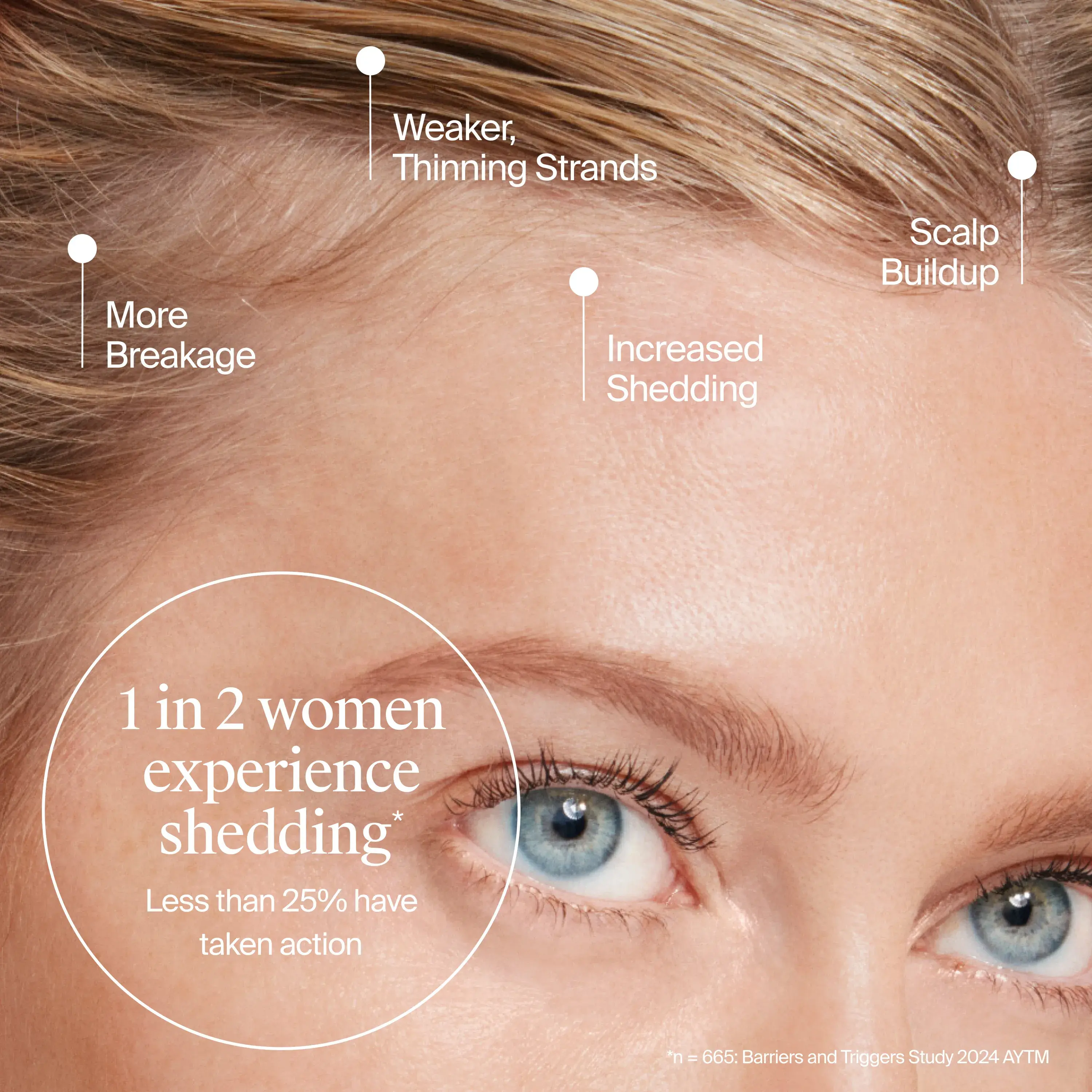 1 in 2 women experience shedding, less than 25% have taken action.
