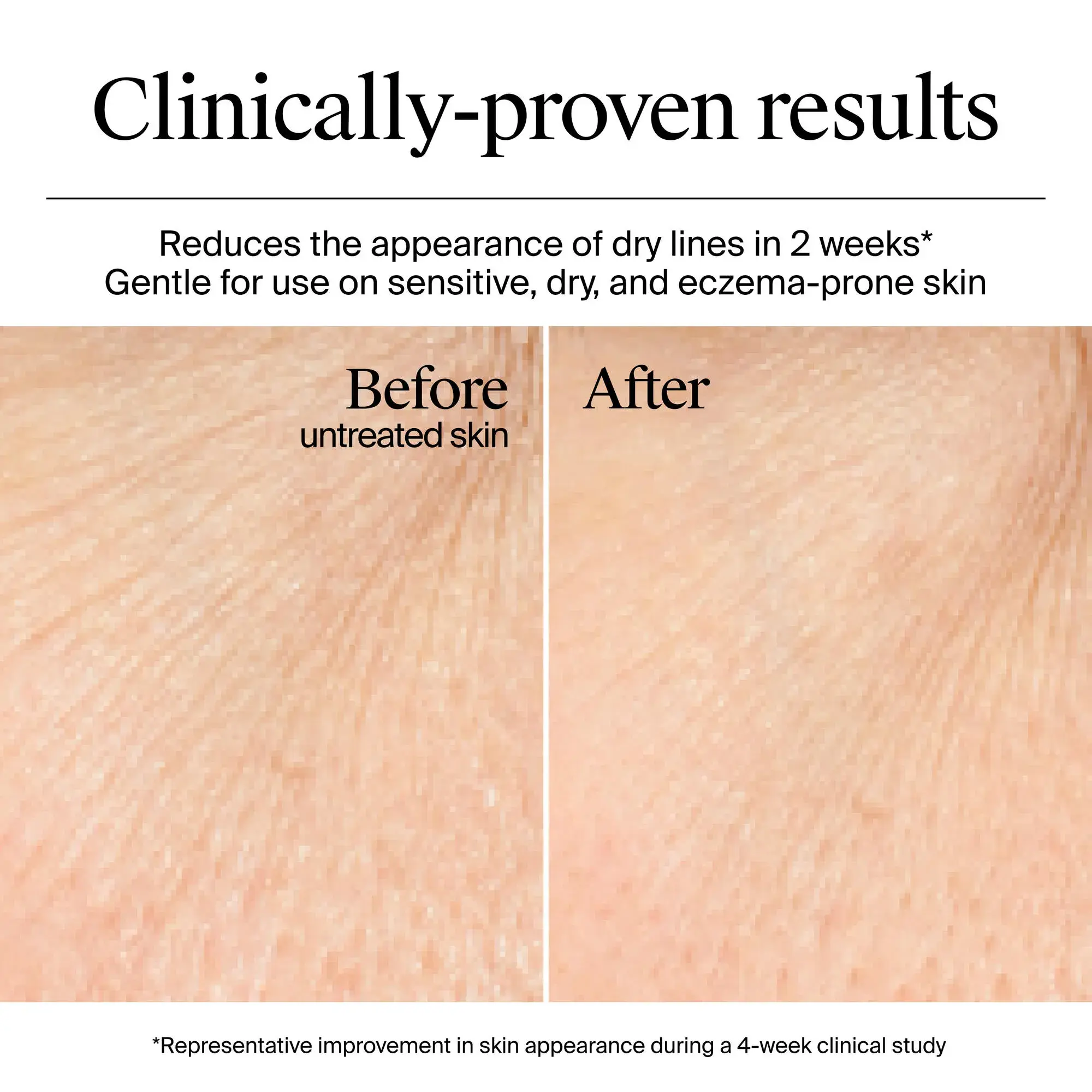 Clinically-proven results.