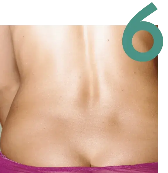 self check image, step 6 - Check your lower back, buttocks, and genital area.