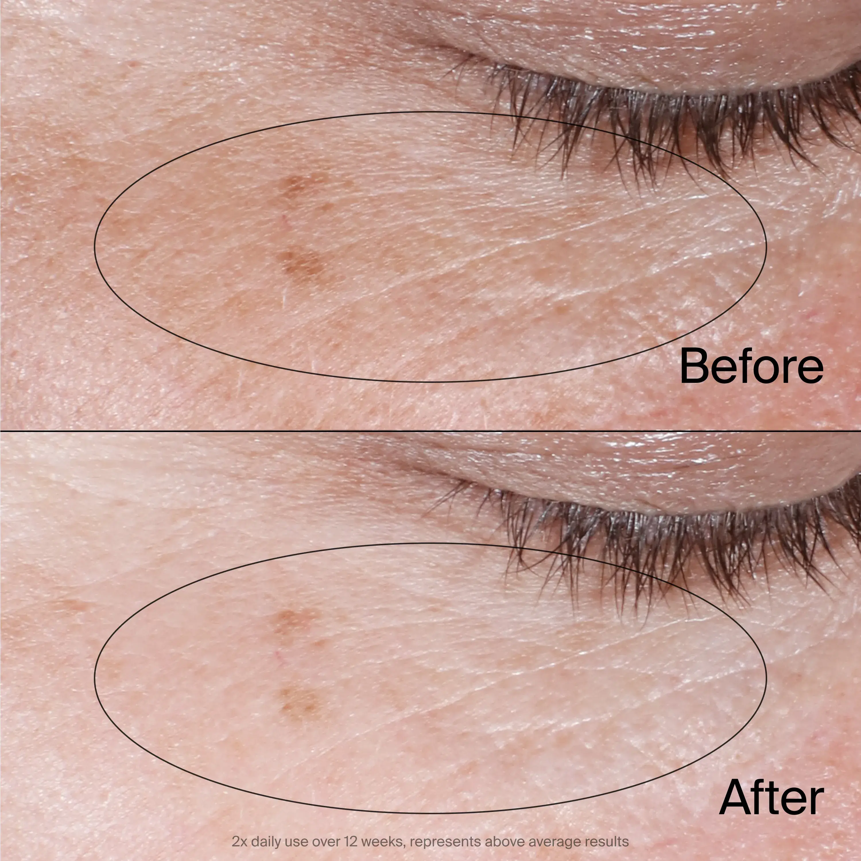 Neutrogena® Collagen Bank Reviving Eye Gel Cream, 0.5 Oz, before and after.