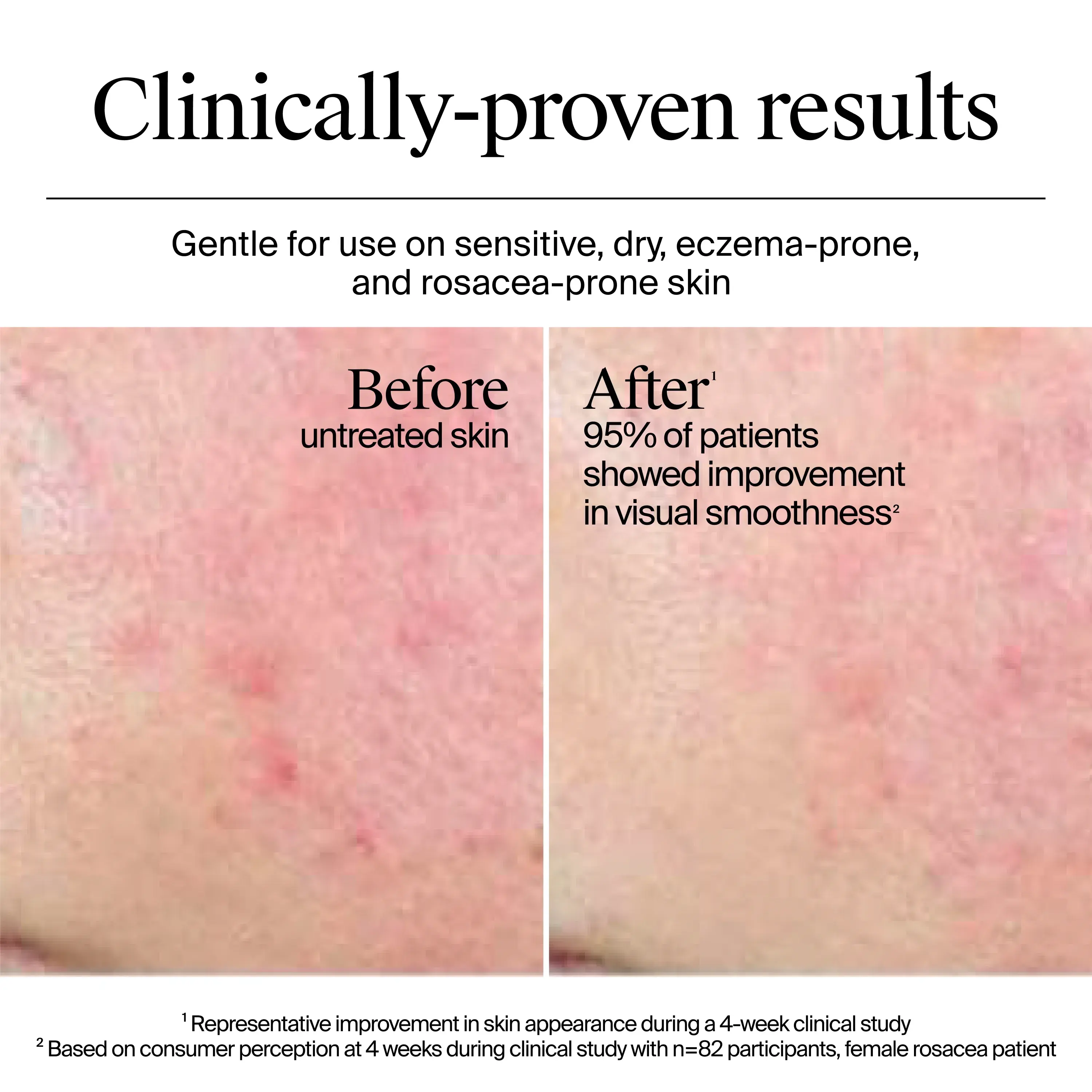 Clinically-proven results.