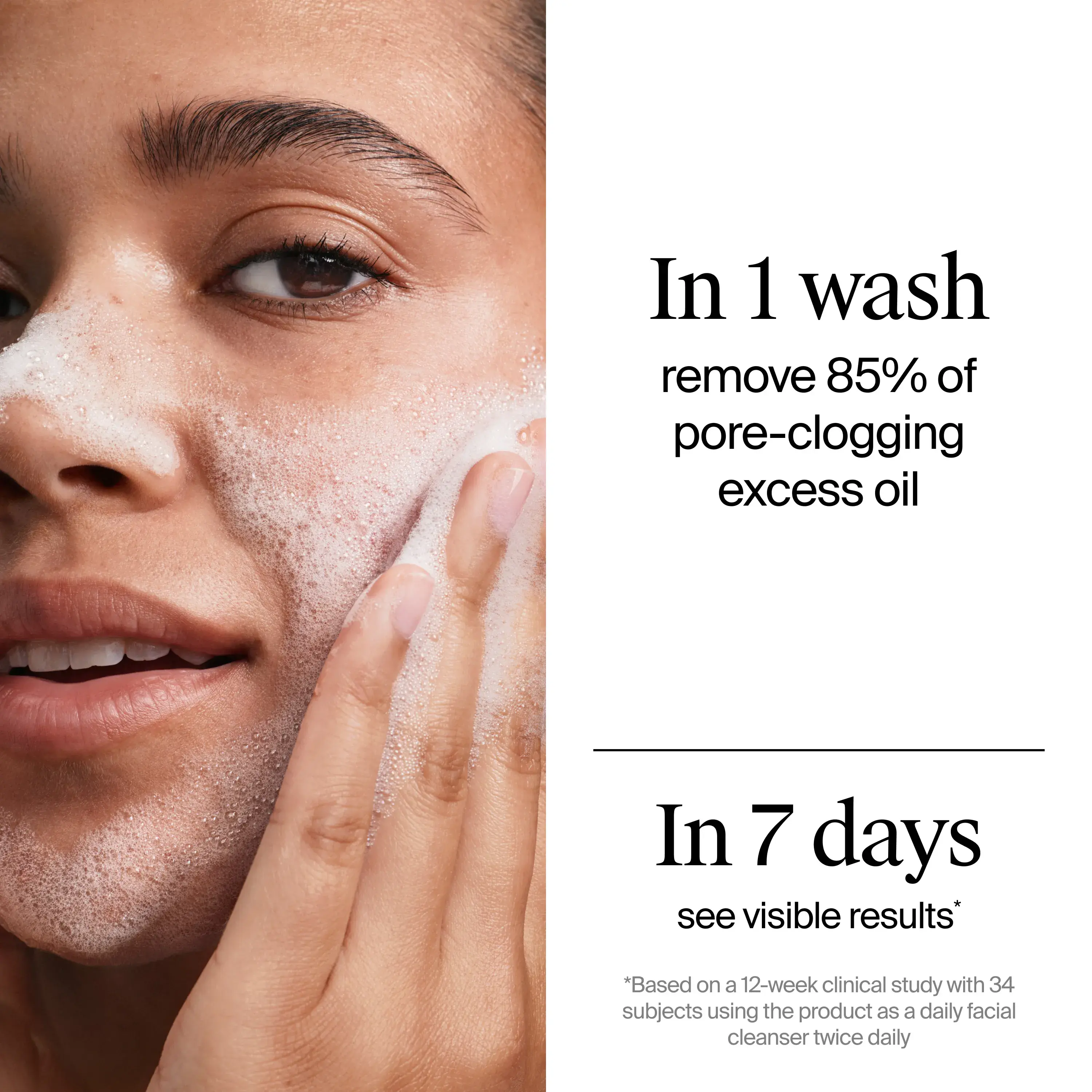 Woman applying Evenly Clear™ Acne Cleanser. In 1 wash remove 85% of pore-clogging excess oil. In 7 days see visible results