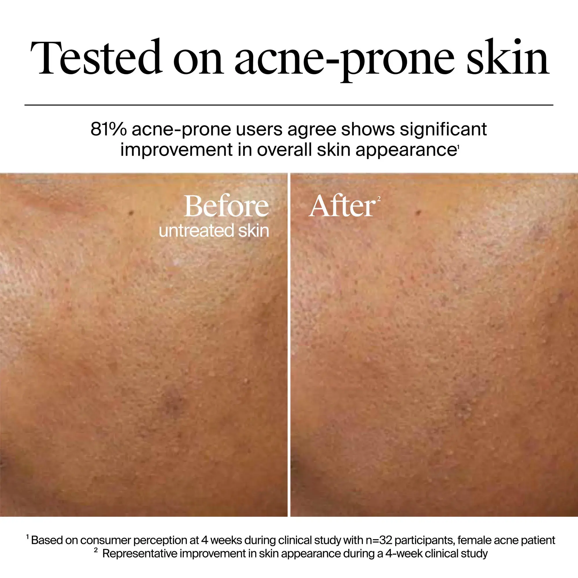 Clinically-proven results