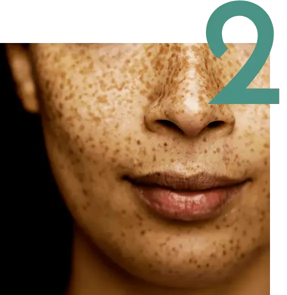self check image, step 2 - Look at your nose, lips, cheeks, and ears with a mirror.