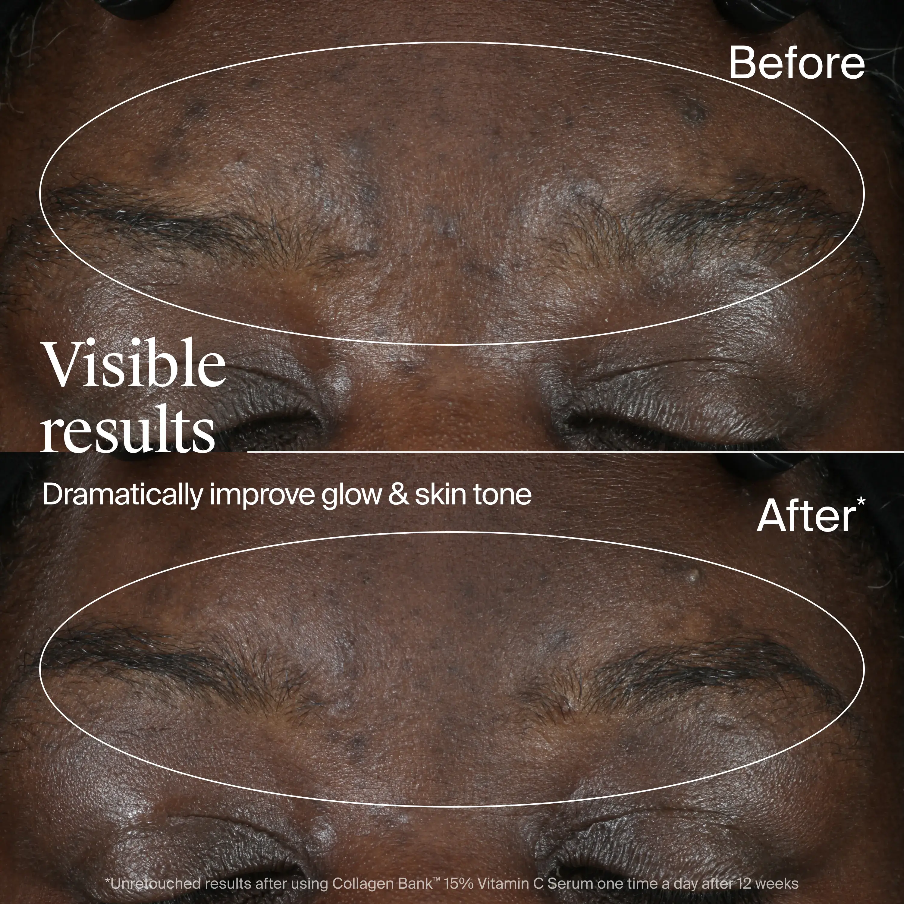Visible results. Dramatically improve glow & skin tone.