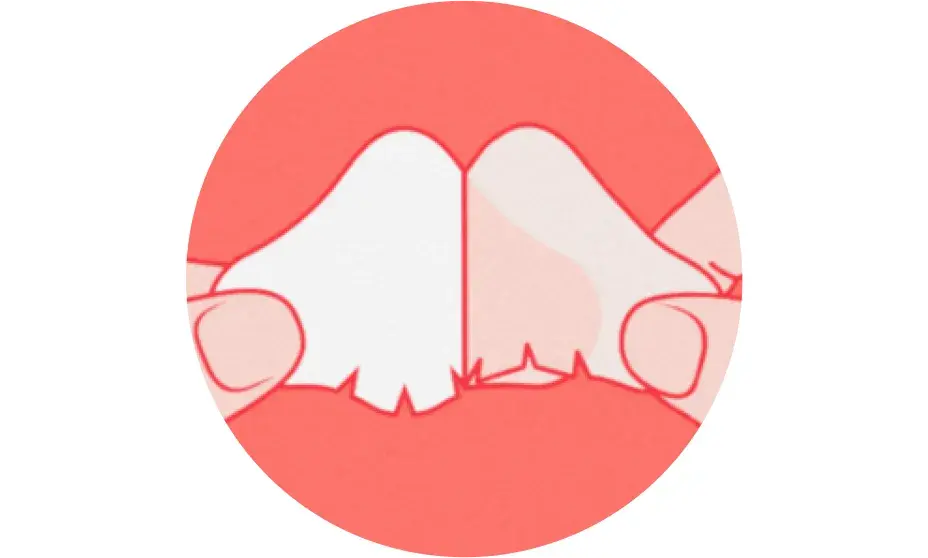 Prep and apply. Cleanse and fully dry skin. Carefully remove backing and apply directly to the nose area. Smooth patch over nose from the middle out.