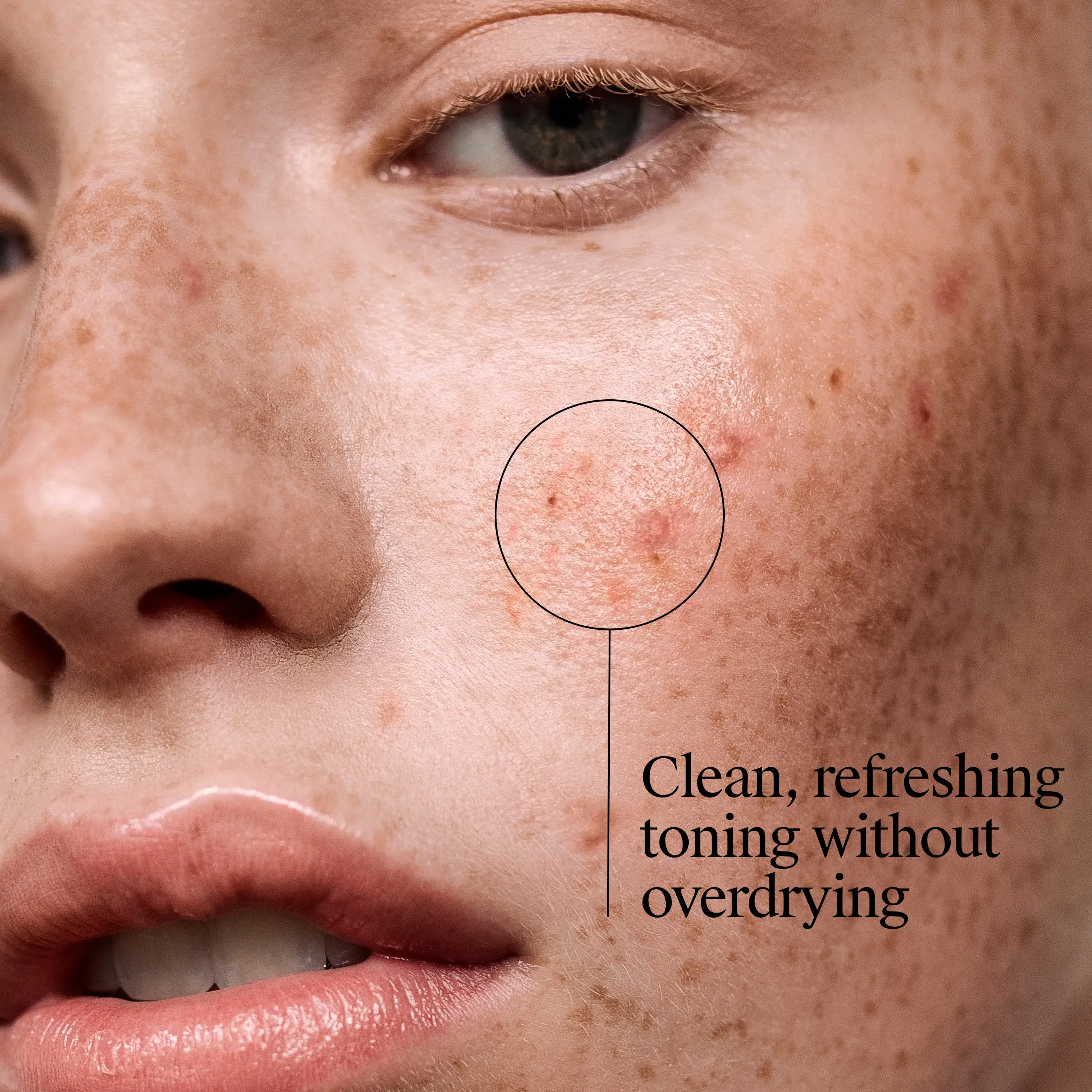 woman's face after using Neutrogena Oil-Free Acne-Fighting Stress Control Triple-Action Toner that is clean refreshing toning without overdrying