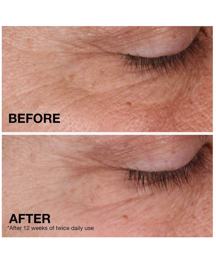 Rapid Wrinkle Repair® Regenerating Anti-Wrinkle Retinol Cream + Hyaluronic Acid