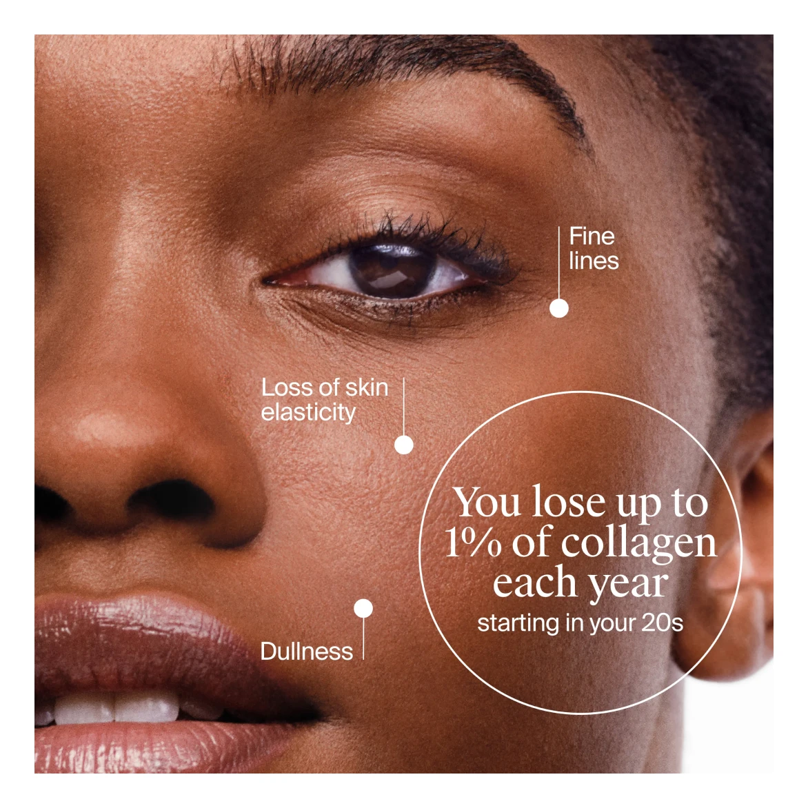 You lose up to 1% of collagen each year, starting in your 20s
