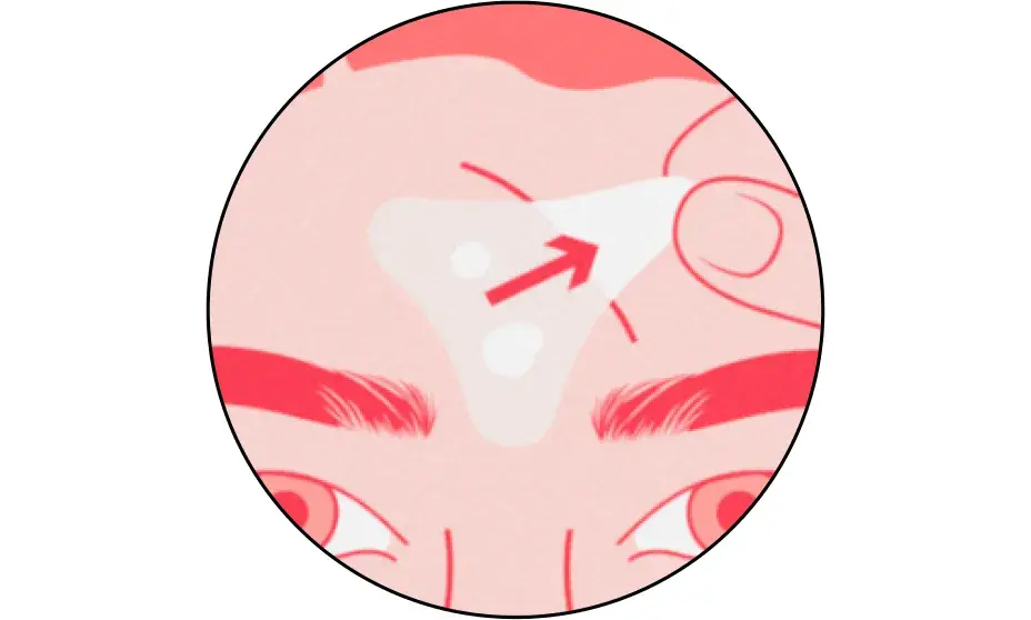 Peel off when patch turns white or 6-8 hours after application.