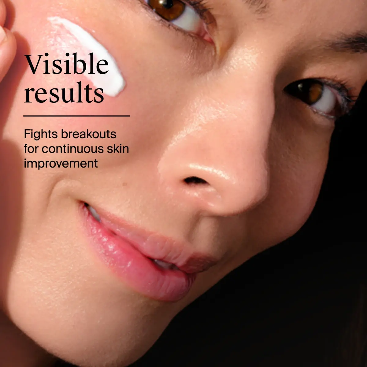 visible results with Rapid Clear Stubborn Acne Spot Gel, fights breakouts for continuous skin improvement