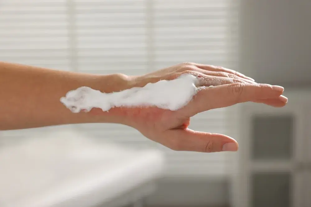Woman with panthenol on her burned hand indoors.