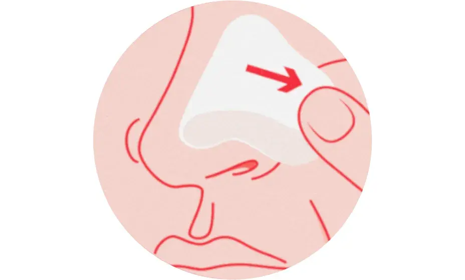 Remove patch. To remove, carefully loosen one end of the patch by stretching it along the skin slowly. Do not pull upward.