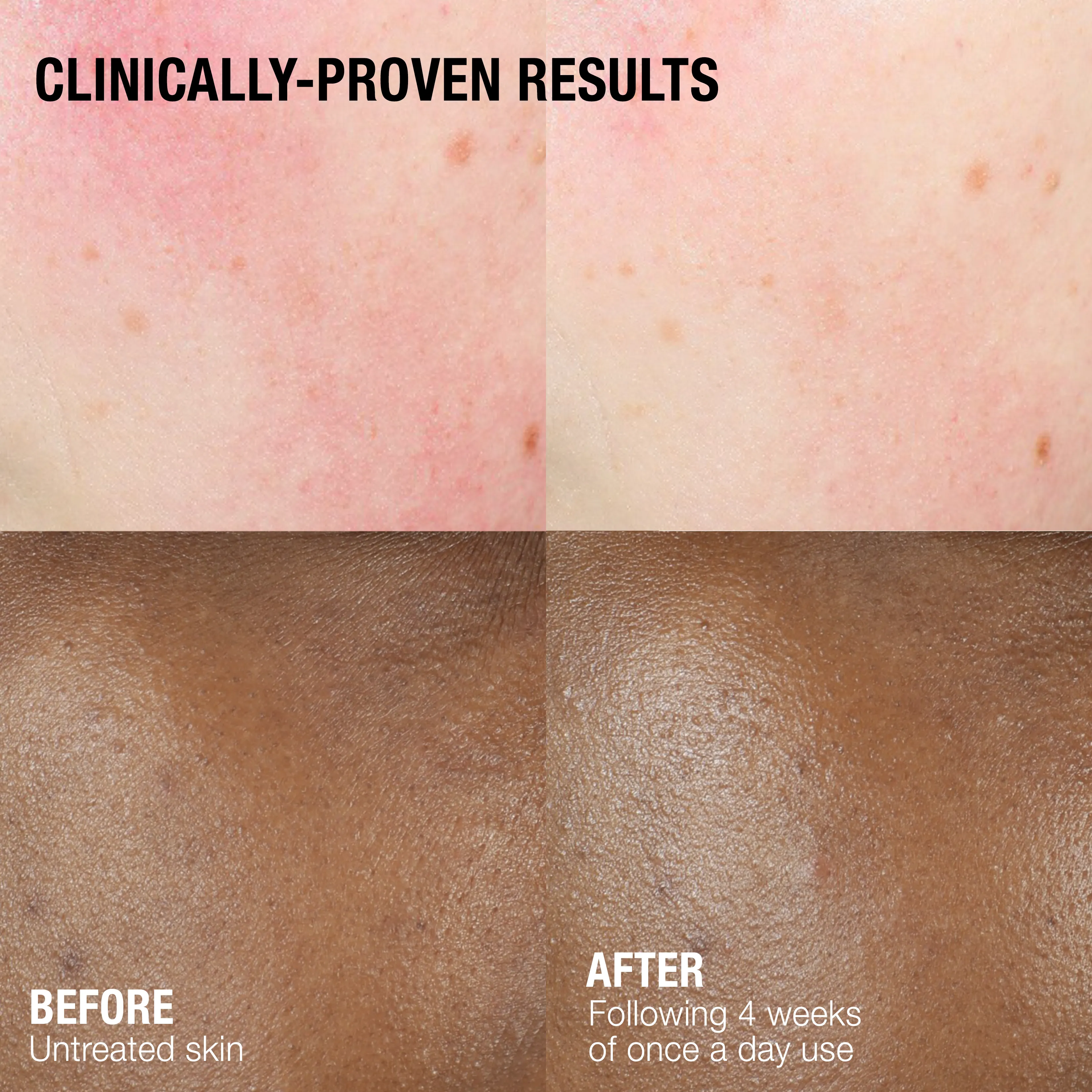 Clinically-proven results.