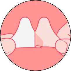 Step 1. Prep and apply. Cleanse and fully dry skin. Peel patch from sheet and apply directly to the acne blemish.