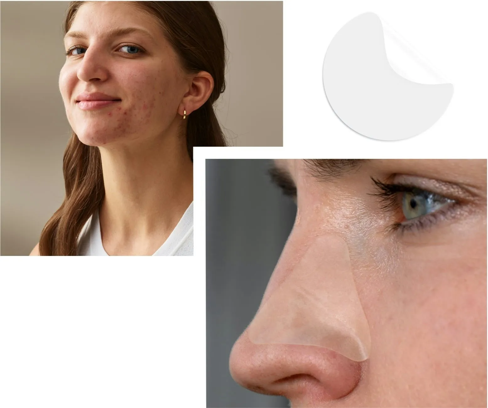 Applied Neutrogena Stubborn Acne Ultra-Thin Blemish Patches