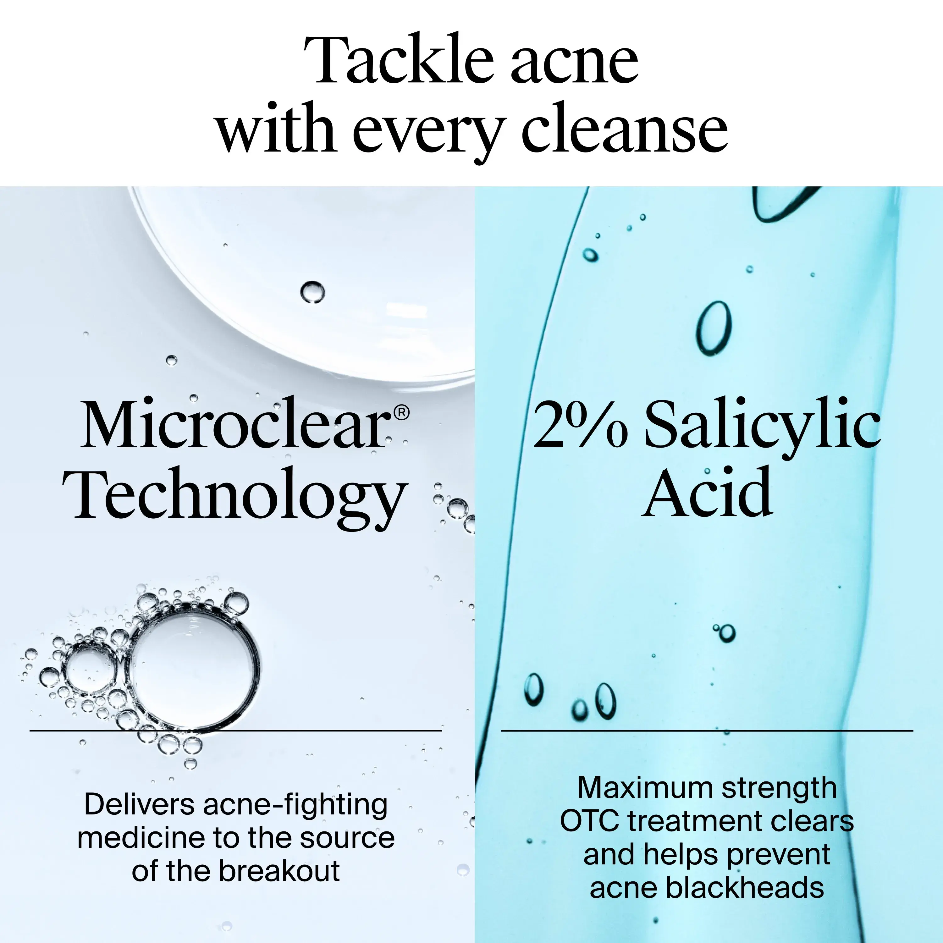Tackle acne with every cleanse. Every cleanse includes Microclear® Technology with acne fighting medicine, 2% Salicylic acid to prevent acne blackheads