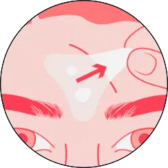 Step 3. Remove patch. Peel off when patch turns white or 6-8 hours after application.