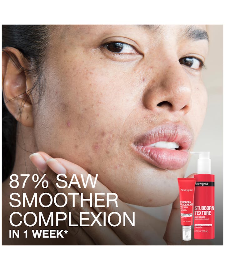 Stubborn Texture&trade; Acne Cleanser for Textured Skin