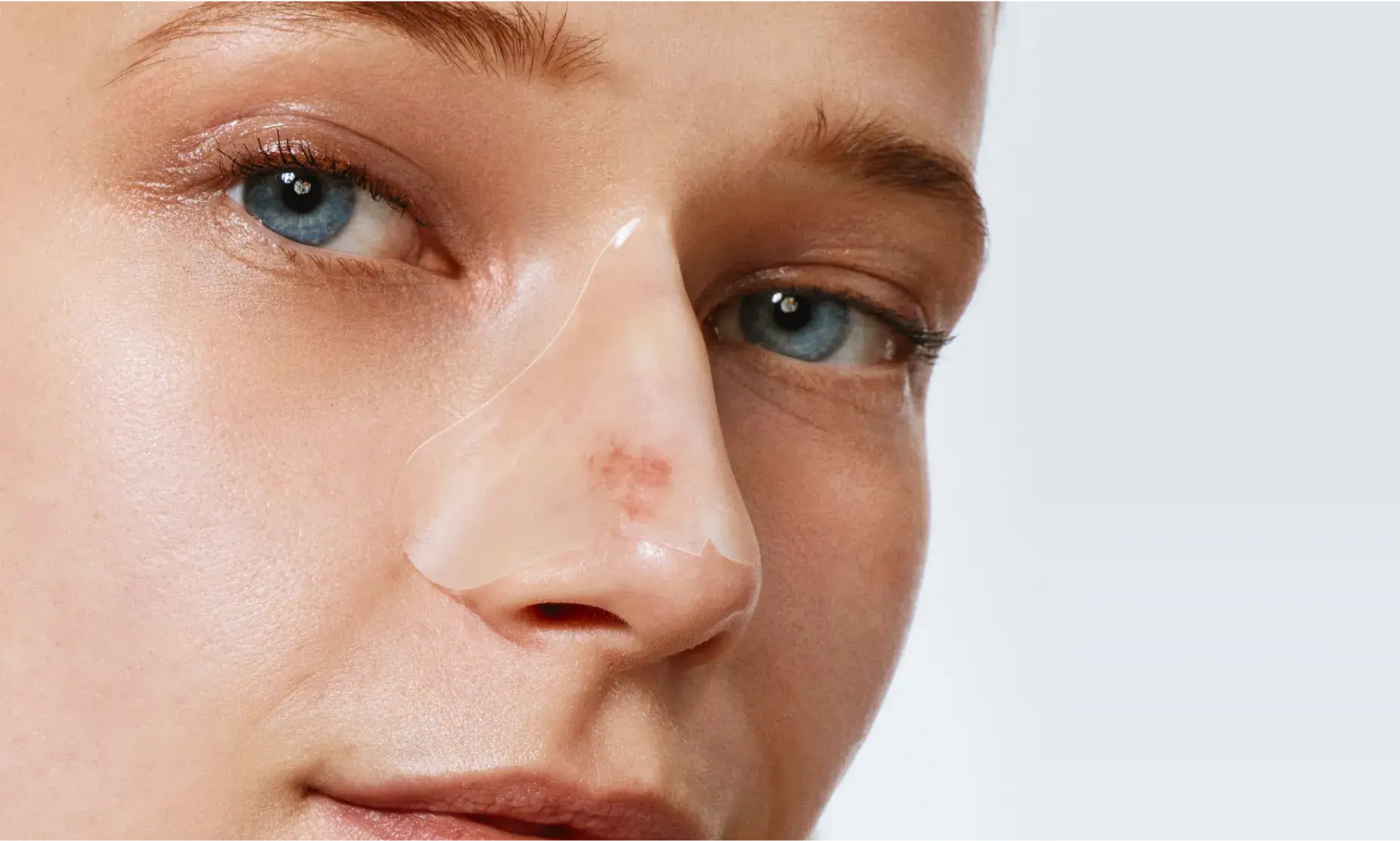  A young woman wearing Neutrogena® nose patch on her face.