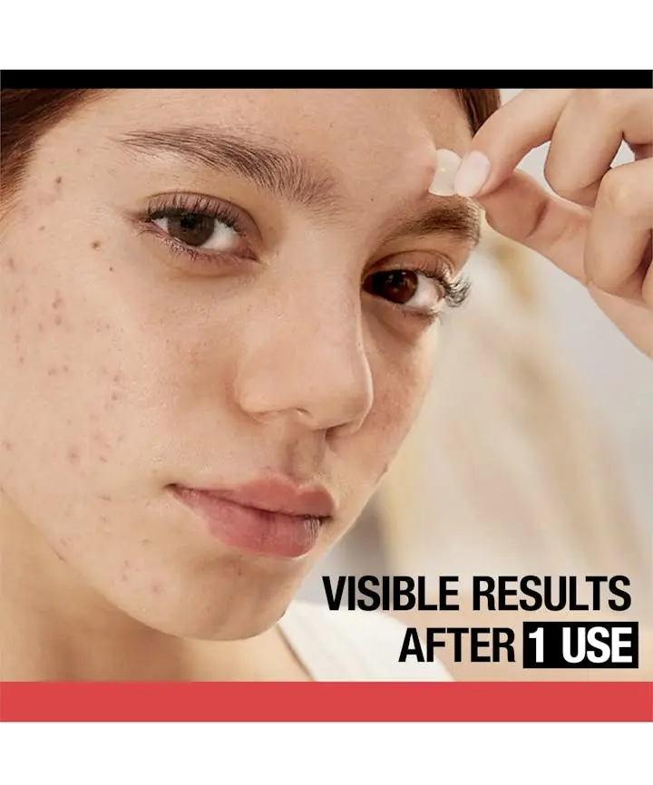 Neutrogena Stubborn Acne® Ultra-Thin Blemish Patches
