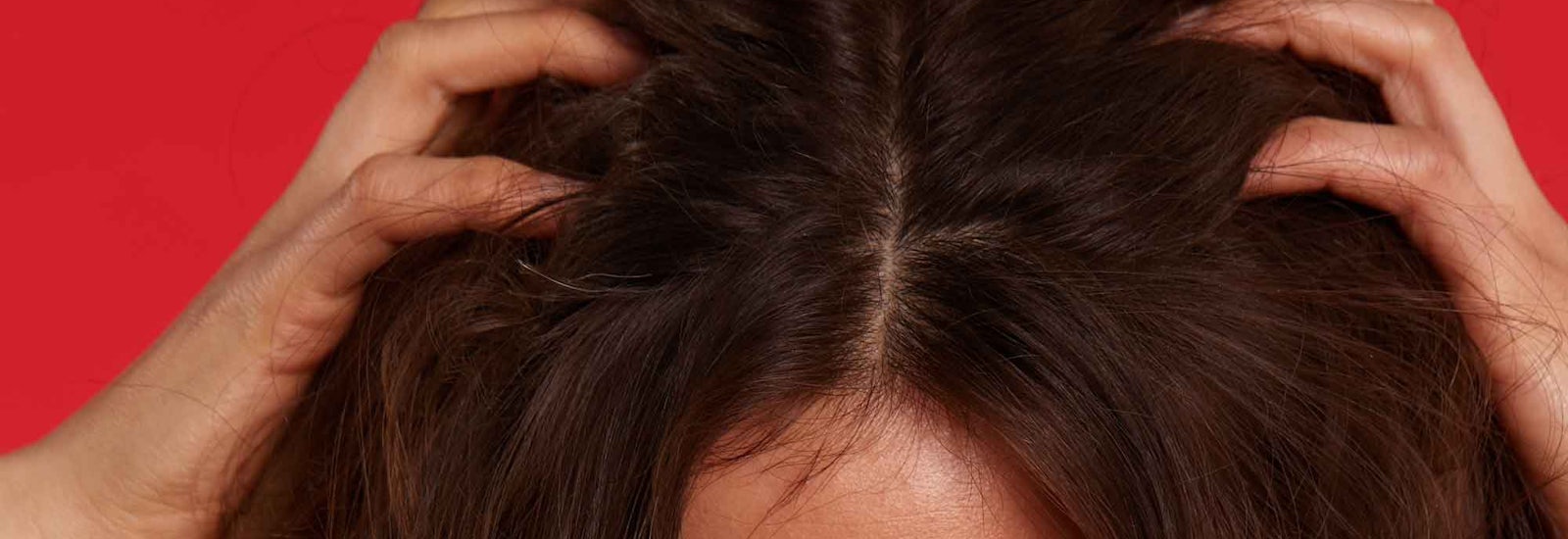 All About Scalp Conditions