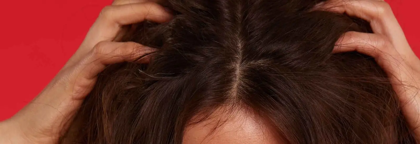 All About Scalp Conditions