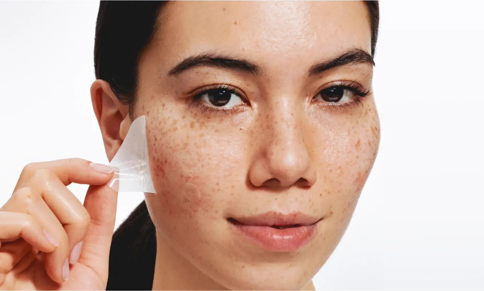 A person with freckles on their face smiles while a hand peels a large, clear acne patch off their cheek.