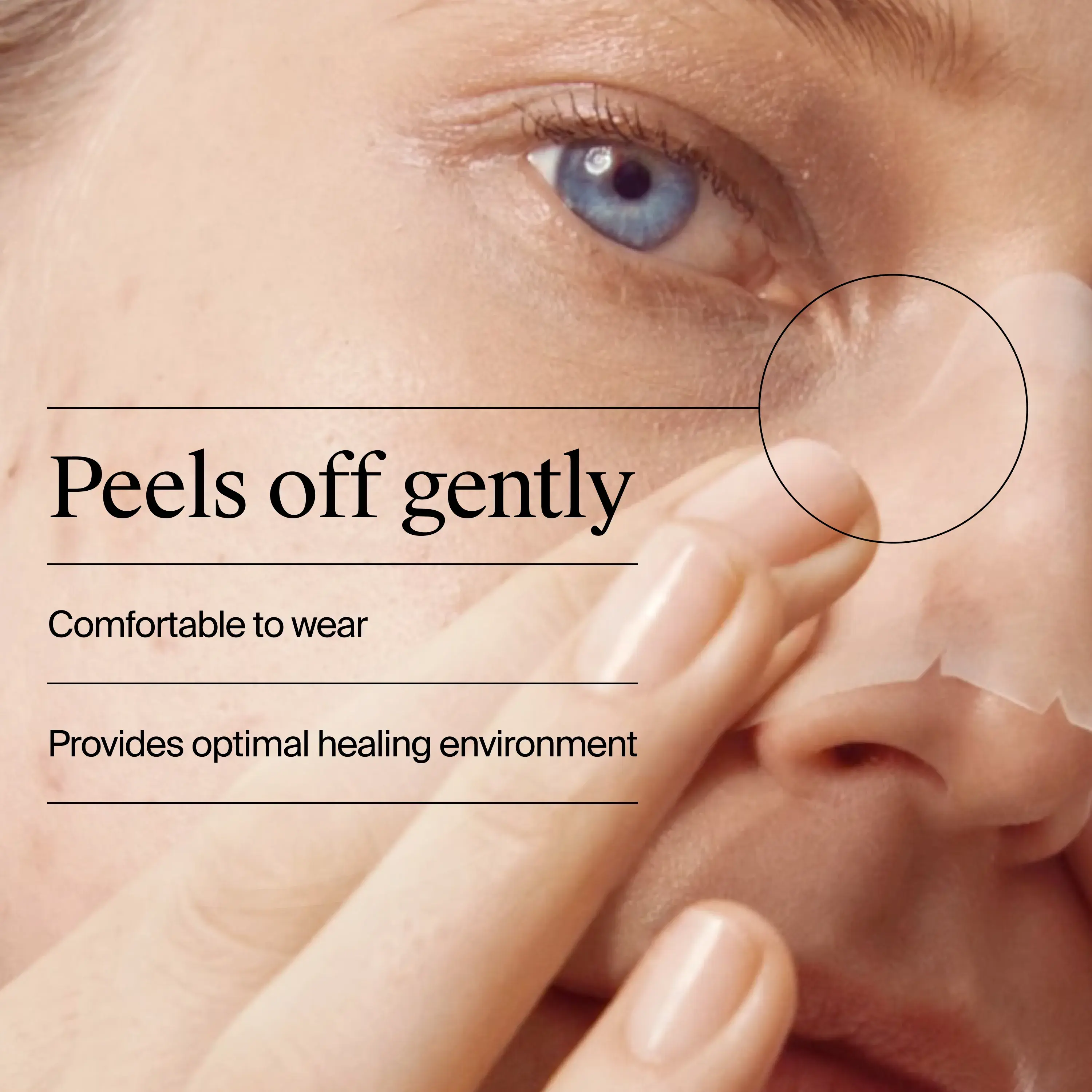 Peels off gently. Comfortable to wear. Provides optimal healing environment.