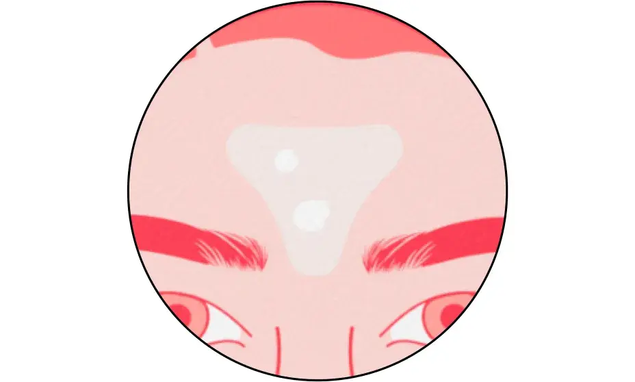 Leave each patch on for 6 hours or overnight. Patch starts to turn white as it absorbs fluid.