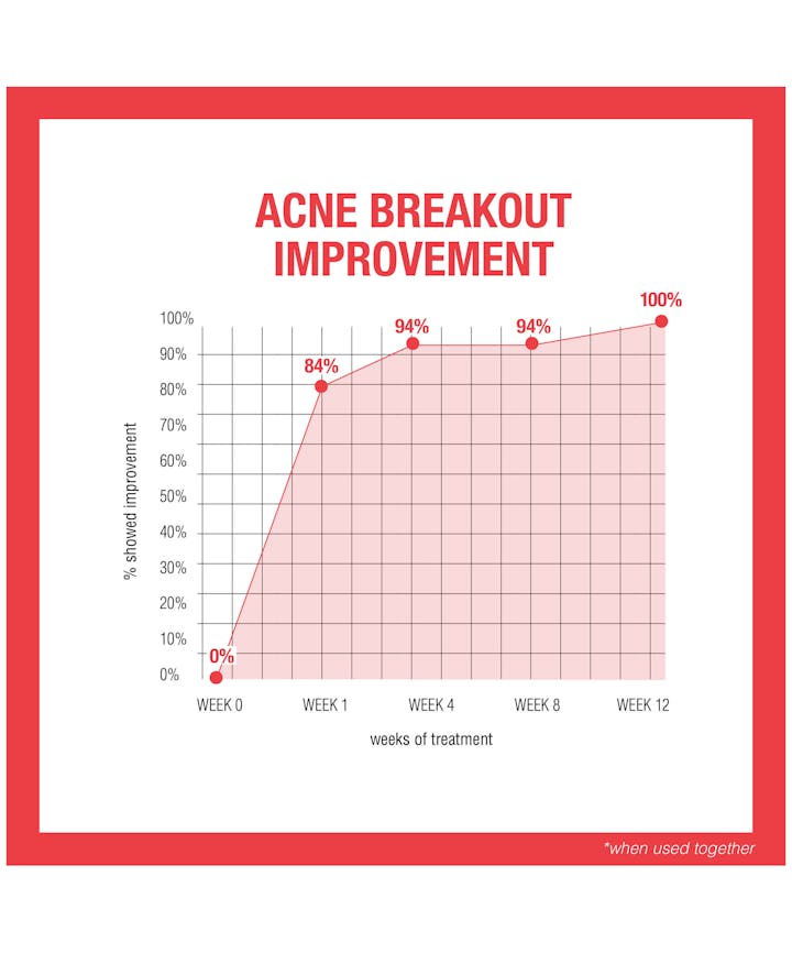 Stubborn Acne AM Treatment