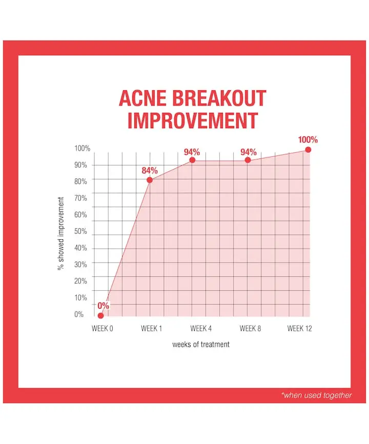Stubborn Acne AM Treatment