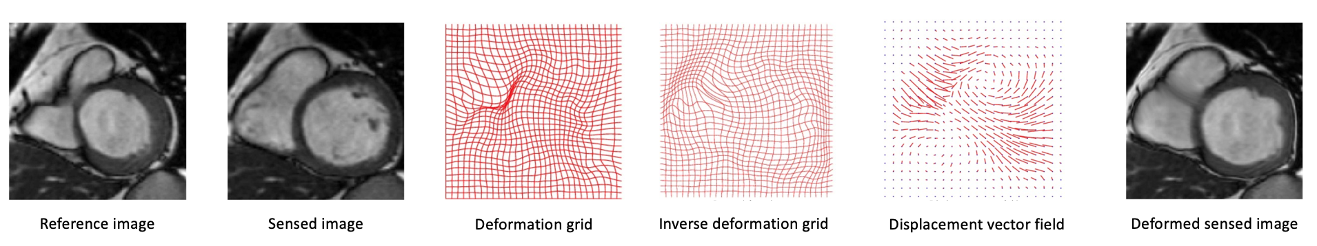 image registration neural network