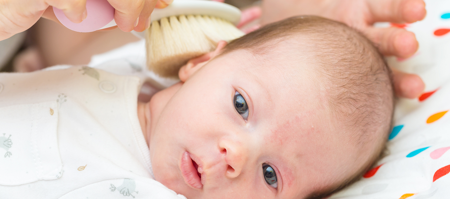 ▷¿Cómo se trata la costra láctea de los bebés?