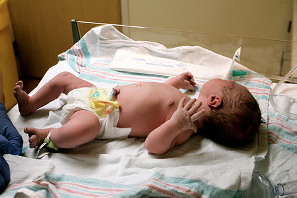 Cuidado Del Cordon Umbilical En Bebes De 0 A 6 Meses