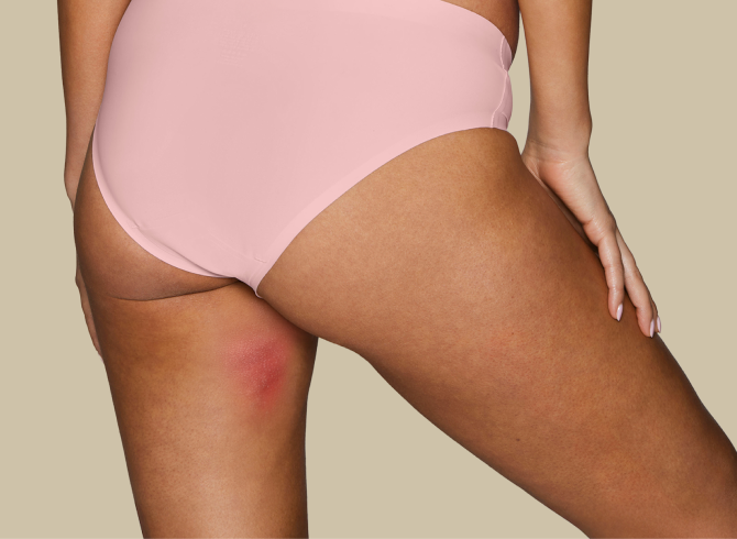 Thigh Saver - Reason #1