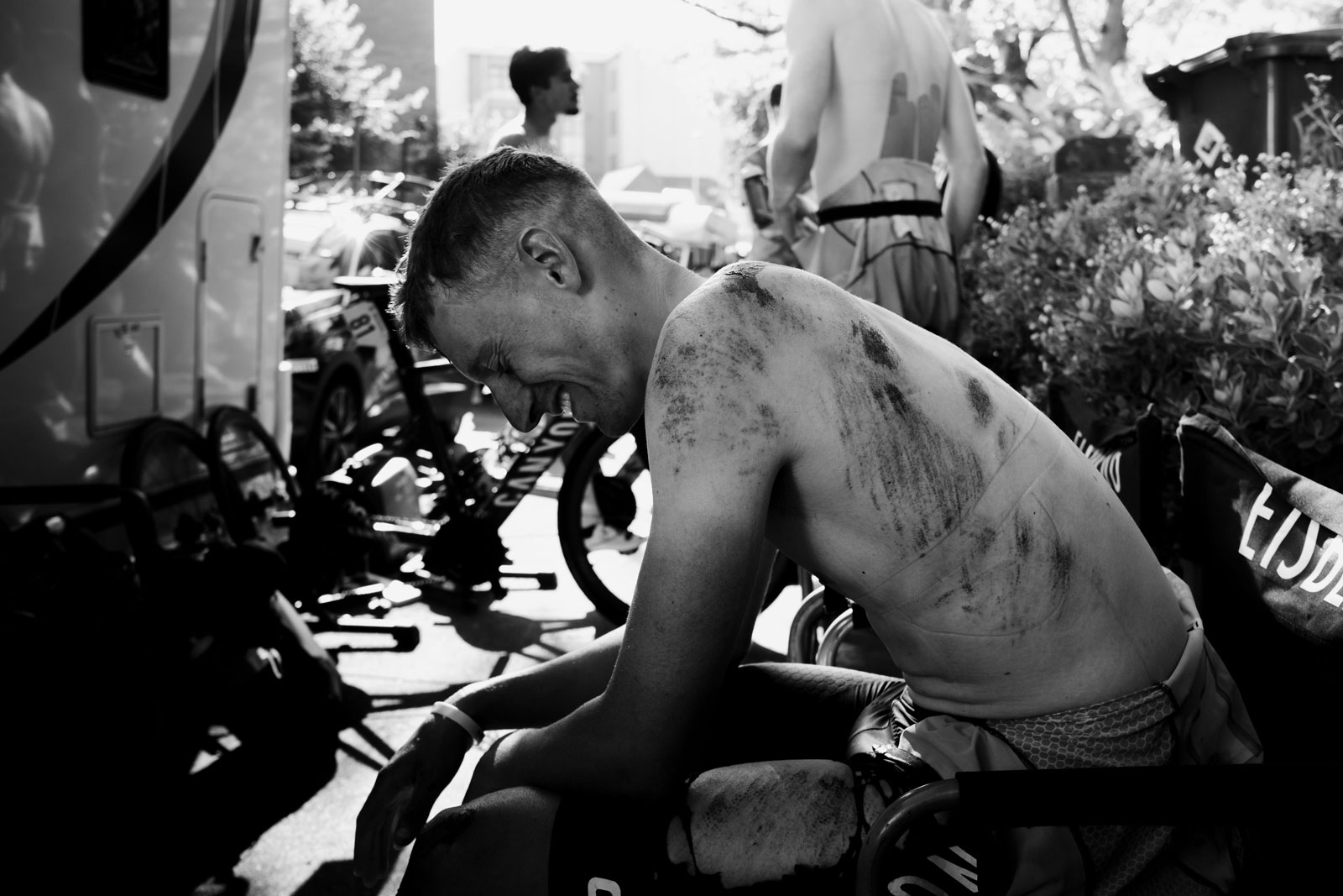 Black and white photo of a man with bruises on his side smiling