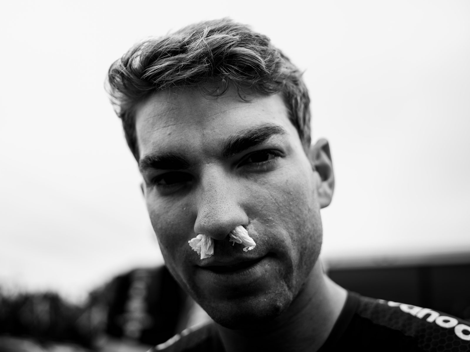 Man with tissue in his nose to stop a nose bleed