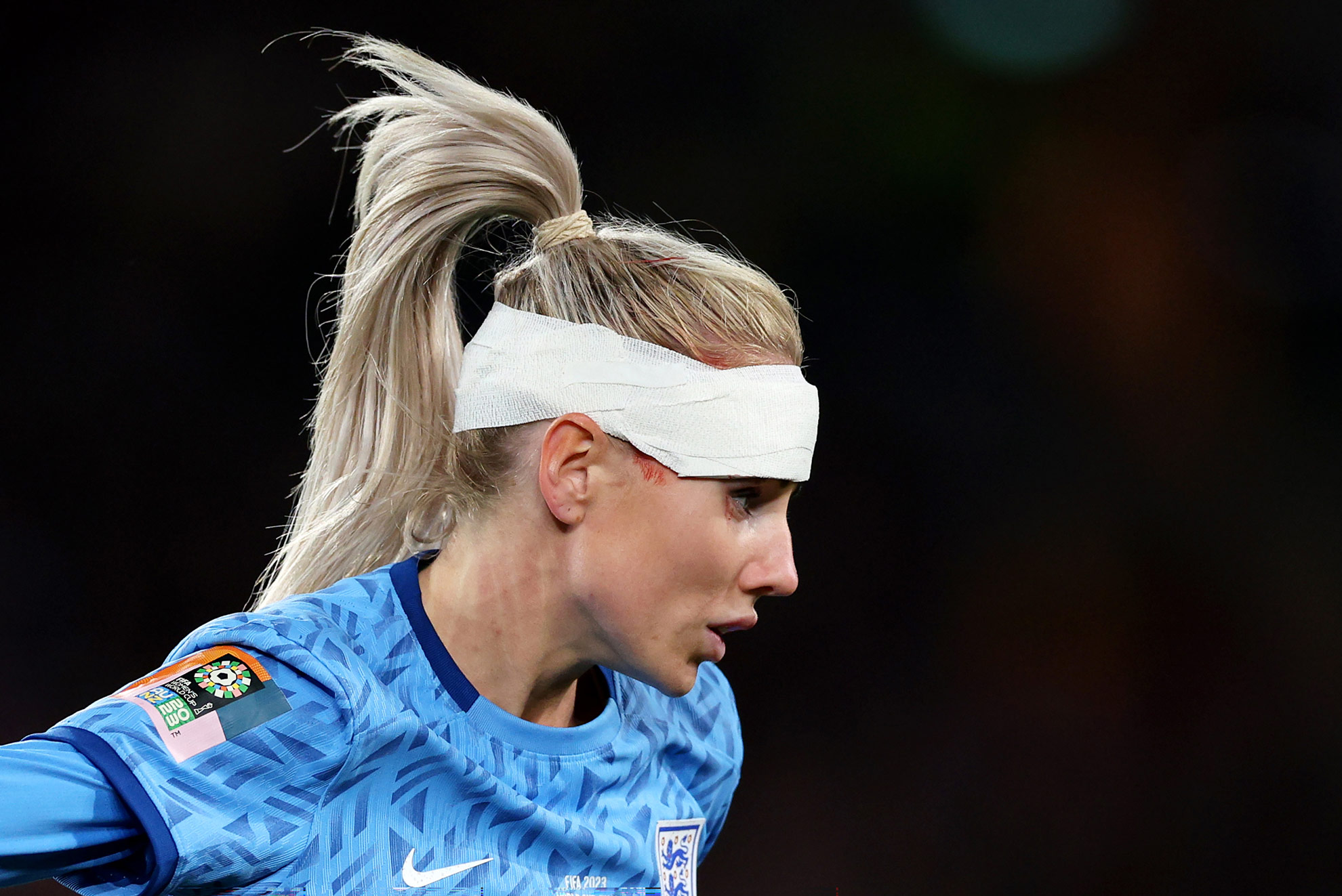 Alex Greenwood of England with a bandage on her head during the 2023 FIFA Women’s World Cup final match between England and Spain. Photo by Elsa Garrison on a Canon EOS R3.