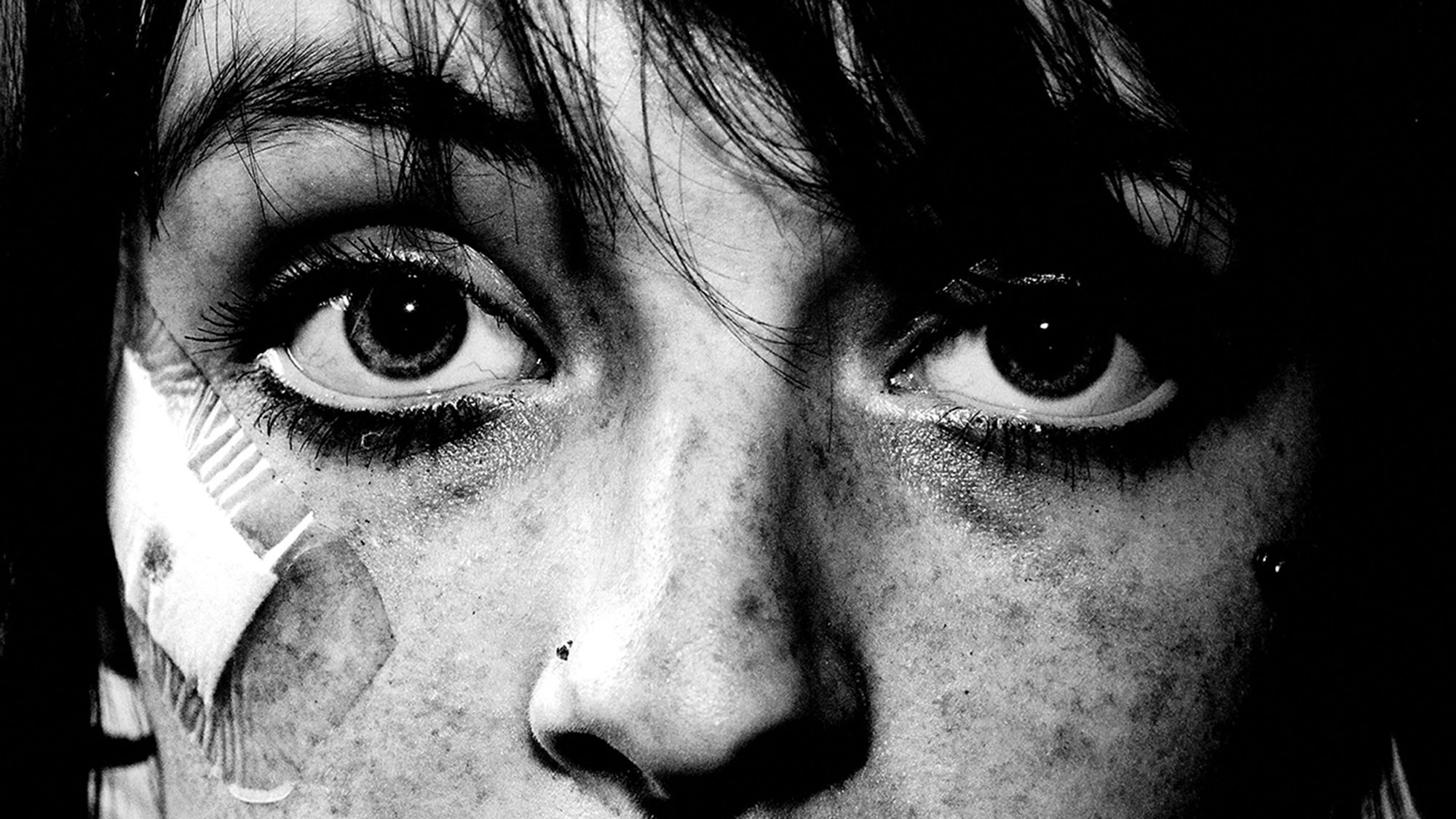 Photographie en noir et blanc d'une personne avec un sparadrap sous l'œil droit, décolletée