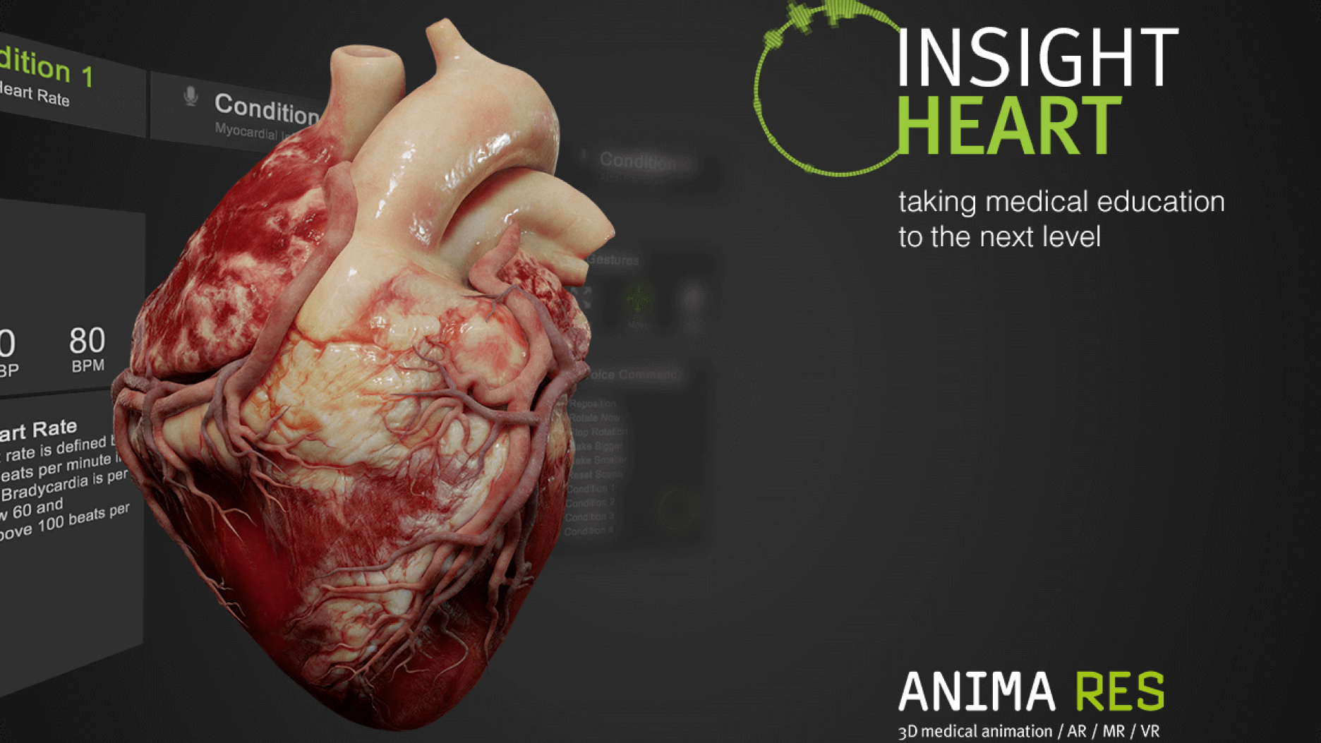 insight heart by anima res | magic leap