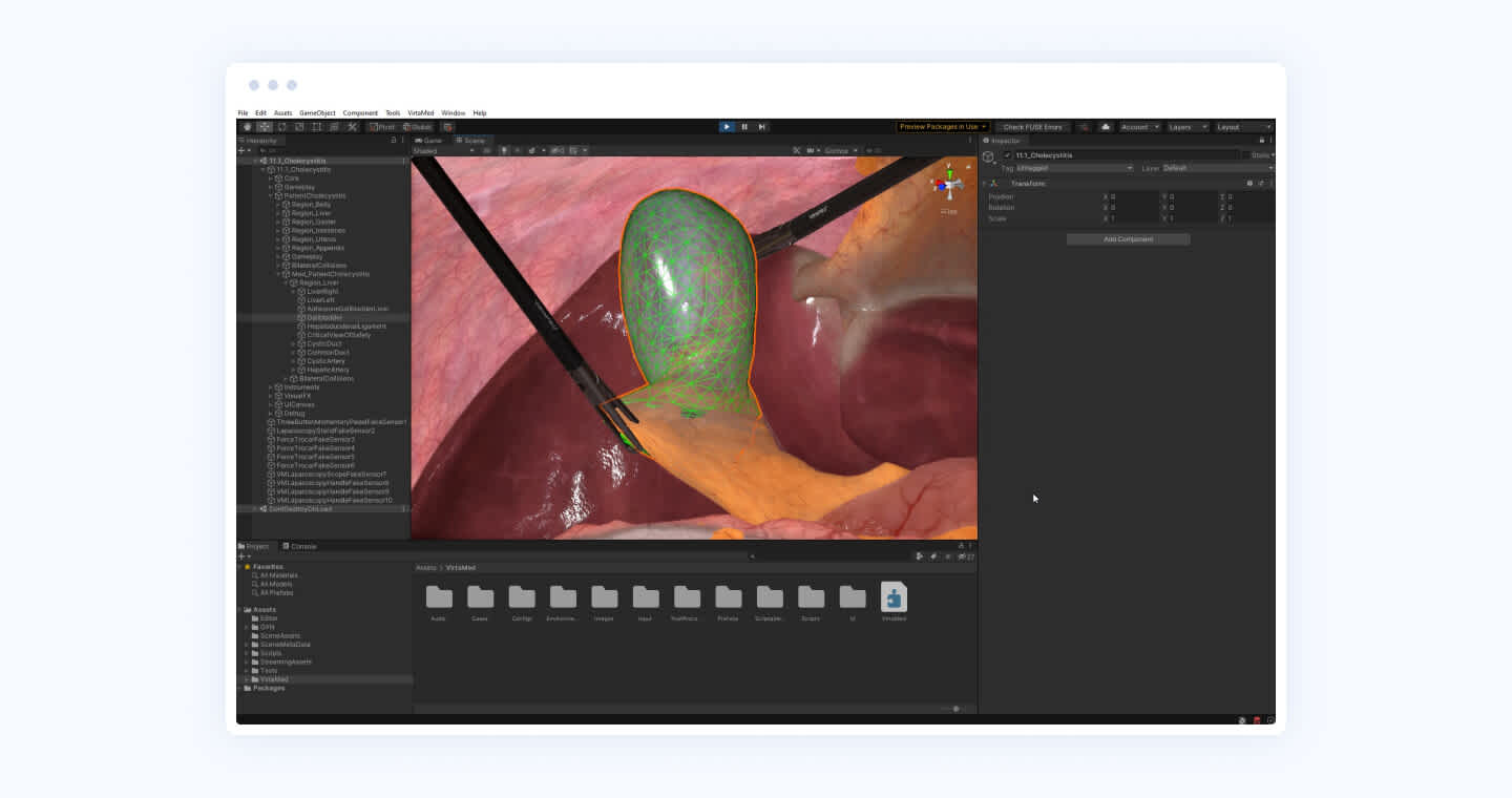 3D simulation surgery software