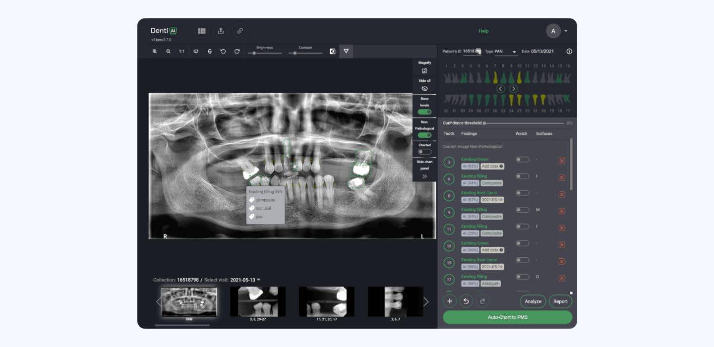 Dental imaging in an app for dentists