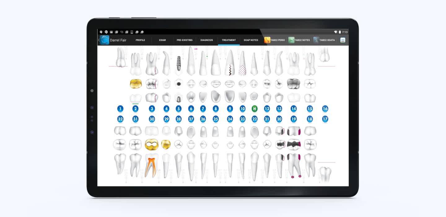 Example of dental charting in a professional app for dentists