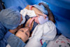 Finding a supportive care provider is key when planning a family-centered cesarean birth.
