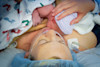 If both you and baby are healthy, skin-to-skin may be possible even in the operating room